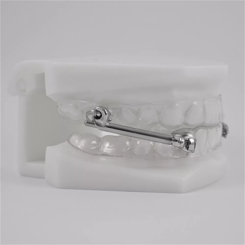 UK Protrusionsschiene, Schnarchschiene, Klasse II Apparatur, DDr. Baudisch, Regau